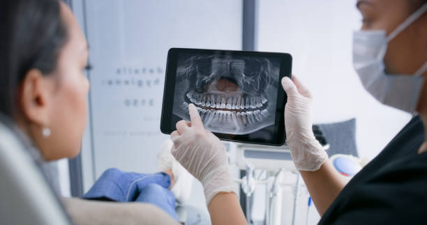 Licensed Root Canal Treatment service in Sarasota Springs, FL - Smile Center Dentistry